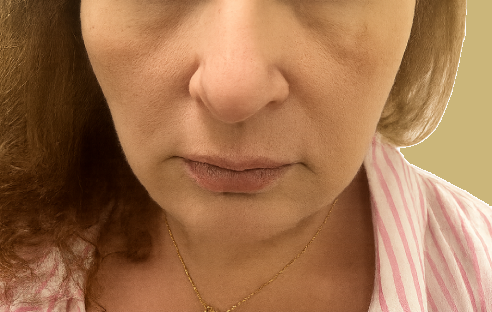Before transformation
